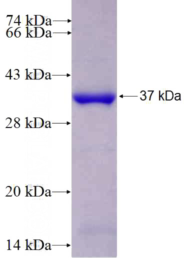 Recombinant Human FBL SDS-PAGE