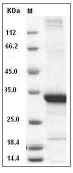 Human Beta-amyloid 42 / Beta-APP42 Protein (His & GST Tag) SDS-PAGE