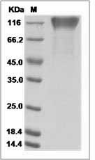 Ebola virus EBOV (subtype Sudan, strain Gulu) GP1 / Glycoprotein Protein (His Tag)