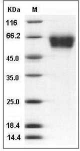 Human CD62L / L-Selectin / SELL Protein (His Tag) SDS-PAGE