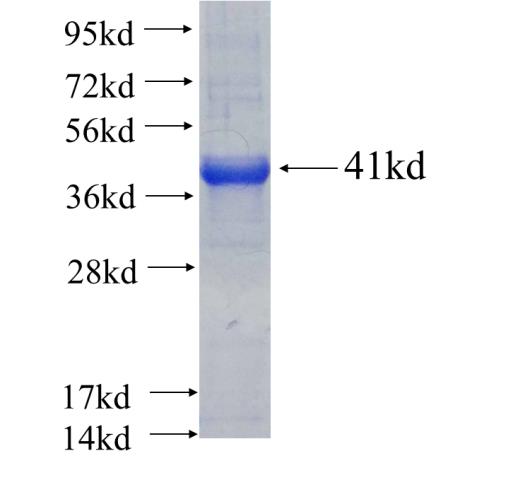 Recombinant human PRPS1L1(Full length) SDS-PAGE