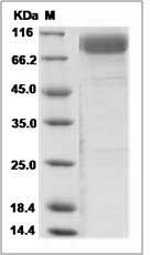 Human IL1RL2 / IL-1Rrp2 Protein (Fc Tag)