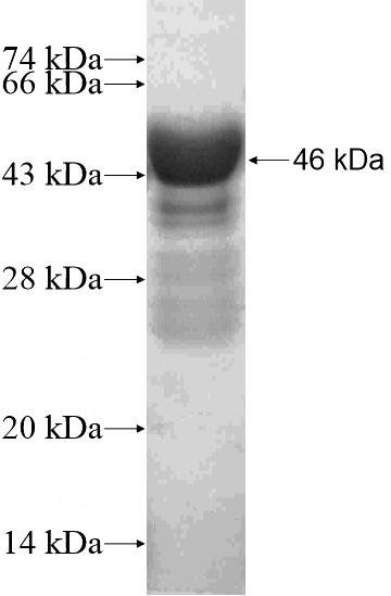 Recombinant Human COL4A5 SDS-PAGE