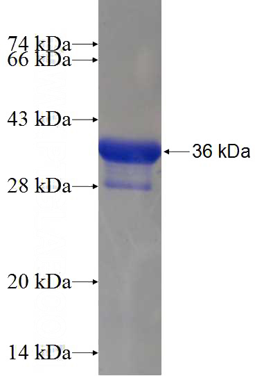 Recombinant Human LSM5 SDS-PAGE