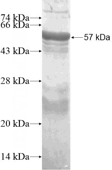 Recombinant Human RSPH9 SDS-PAGE