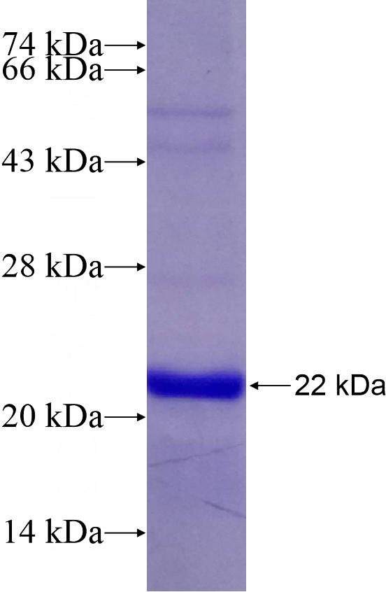 Recombinant Human FOXM1 SDS-PAGE
