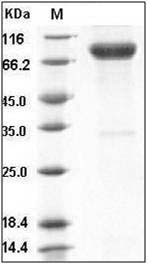 Human IL-1R8 / IL1RAPL1 Protein (Fc Tag) SDS-PAGE
