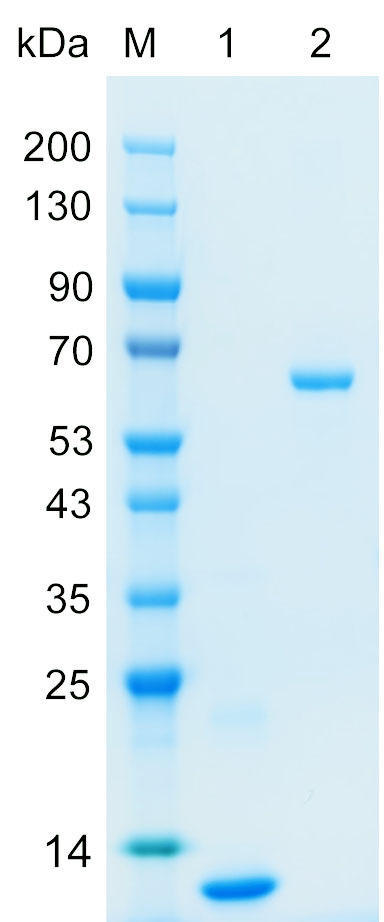 Recombinant KV315 protein (His tag) SDS-PAGE