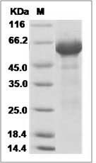 Influenza A H5N1 (A/chicken/Jilin/9/2004) Hemagglutinin Protein (His Tag)