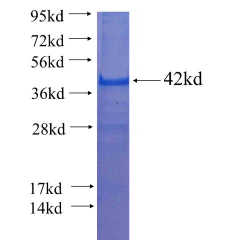 Recombinant Arabidopsis thaliana ATNTRB SDS-PAGE