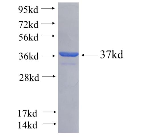 Recombinant human SIKE1 SDS-PAGE