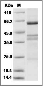 Human EGFL6 / EGF-L6 Protein (His Tag) SDS-PAGE