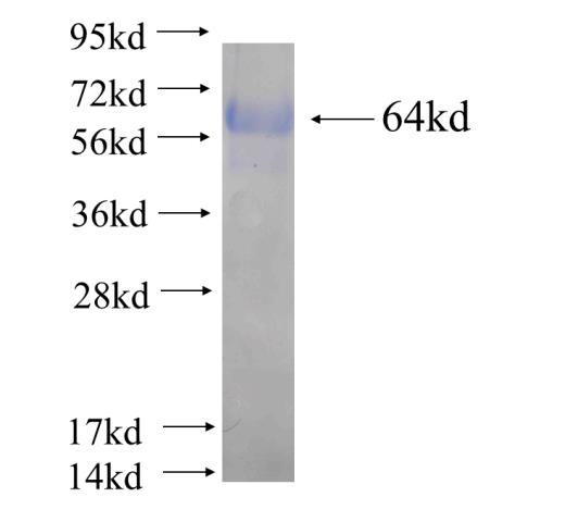 Recombinant human DNAJB4(Full length) SDS-PAGE