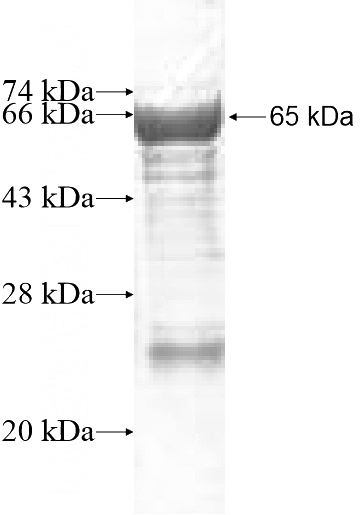 Recombinant Human DDX19A SDS-PAGE