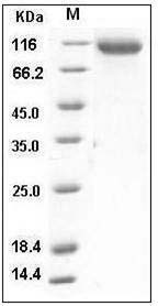 Mouse ASAH2 Protein (His Tag) SDS-PAGE