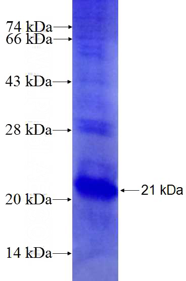 Recombinant Human CCDC3 SDS-PAGE