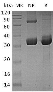 Human LMAN2L/VIPL/PSEC0028/UNQ368/PRO704 (His tag) recombinant protein