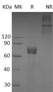 Human IL20RA/UNQ681/PRO1315 (Fc tag) recombinant protein