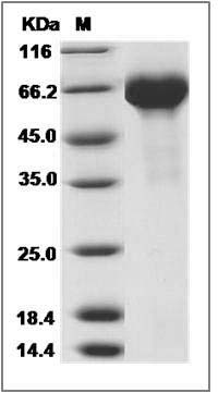 Influenza A H7N9 (A/Shanghai/2/2013) Hemagglutinin / HA Protein (His Tag) SDS-PAGE