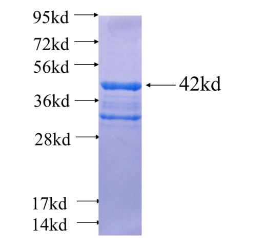 Recombinant human TOMM22(Full length) SDS-PAGE