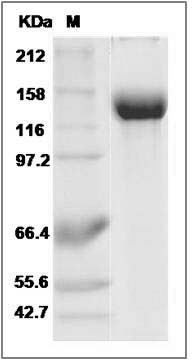 Mouse Siglec-2 / CD22 Protein (Fc Tag) SDS-PAGE