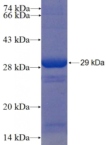 Recombinant Human RB1 SDS-PAGE
