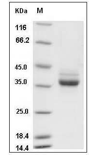 Human CSAGE / CSAG1 Protein (Fc Tag) SDS-PAGE