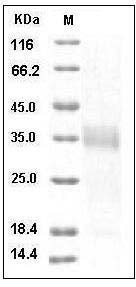 Human Ephrin-A3 / EFNA3 Protein SDS-PAGE