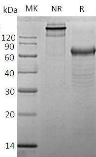 Human F3 (His tag) recombinant protein