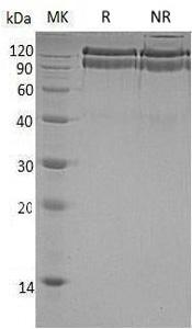 Human ADGRB3/BAI3/KIAA0550 (His tag) recombinant protein