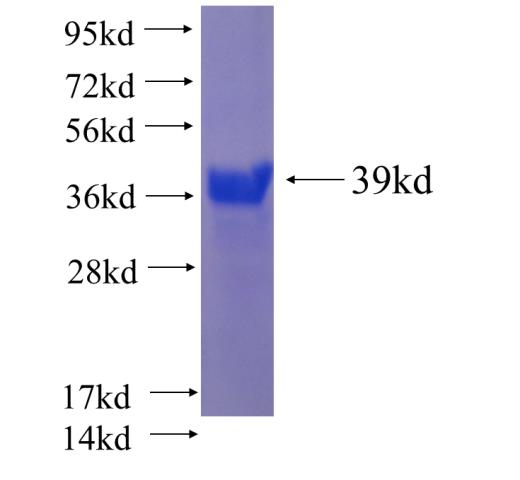 Recombinant Arabidopsis thaliana BBX1 SDS-PAGE