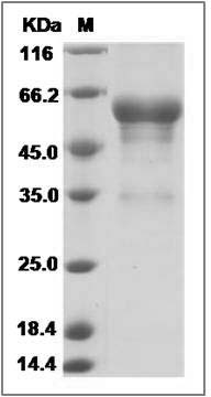 Human PRNP / Prion Protein (Fc Tag) SDS-PAGE