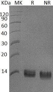 Human SPINK1/PSTI (His tag) recombinant protein