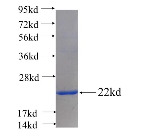 Recombinant human RPL28(Full length) SDS-PAGE