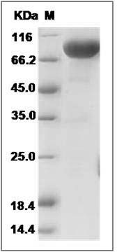 Rat CD5 Protein (Fc Tag) SDS-PAGE