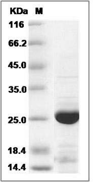 Human COMMD9 Protein (His Tag) SDS-PAGE