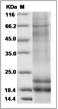 Rat Cripto / TDGF1 Protein (His Tag) SDS-PAGE