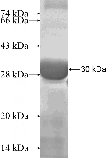 Recombinant Human PPP1R16B SDS-PAGE