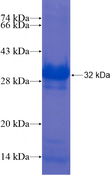 Recombinant Human LRRC19 SDS-PAGE