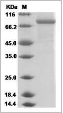 Mouse CHST5 / GlcNAc6ST-3 Protein (Fc Tag)