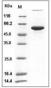 Human P4HB / ERBA2L Protein (His Tag) SDS-PAGE
