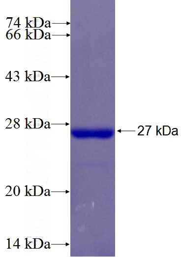 Recombinant Human WDR91 SDS-PAGE