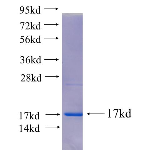 Recombinant human TTC39A SDS-PAGE