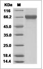 Influenza A H12N1 (A/mallard duck/Alberta/342/1983) Hemagglutinin / HA Protein (His Tag)