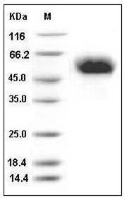 Influenza A H4N6 (A/mallard/Ohio/657/2002) Hemagglutinin Protein (HA1 Subunit) (His Tag) SDS-PAGE