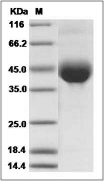 Canine NRG1-alpha Protein (His Tag) SDS-PAGE