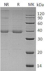 Human UQCRH (GST tag) recombinant protein