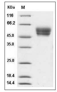 Mouse CADM4 / IGSF4C / TSLL2 Protein (His Tag) SDS-PAGE