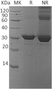 Human IMPA1/IMPA (His tag) recombinant protein