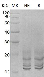Human GNRH2 (His tag) recombinant protein